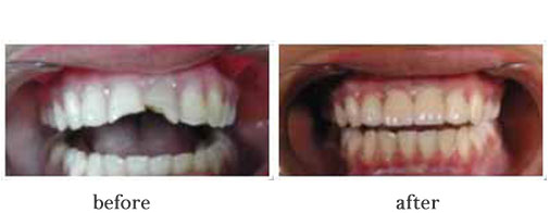 smile 3